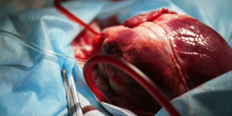 ۵۲ عمل باز قلب طی سال جاری در سنندج انجام شد