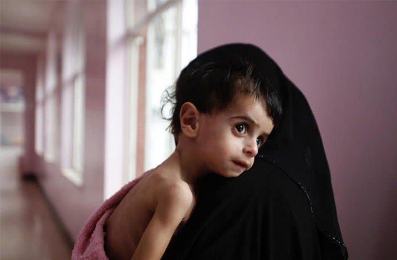 خدمات کمیته امداد کردستان به مادران باردار و شیرده دچار سوء تغذیه